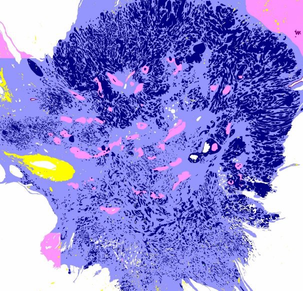 Histology Segmentation