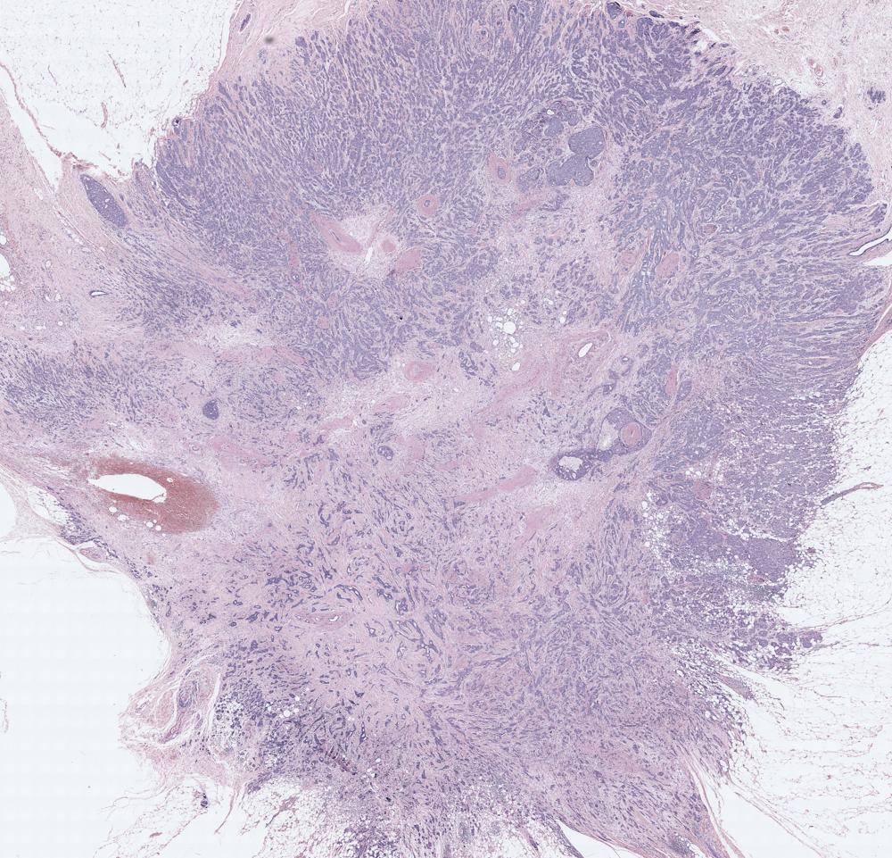 Histology Image
